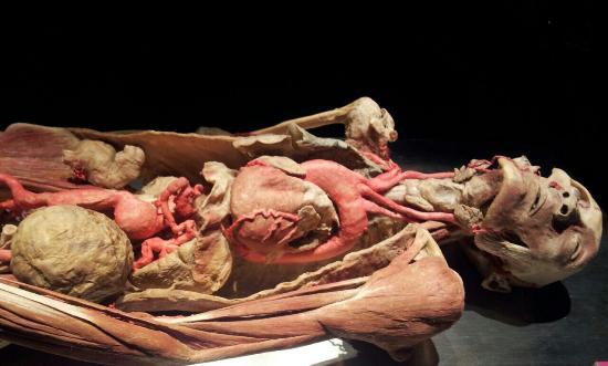 Body Worlds